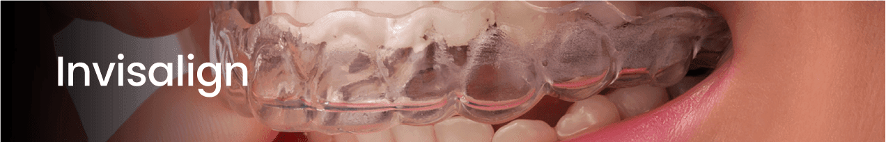 Pillar Page_Teeth Straightening-02