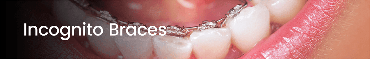 Pillar Page_Teeth Straightening-03
