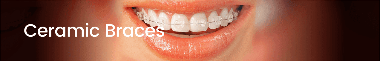 Pillar Page_Teeth Straightening-04