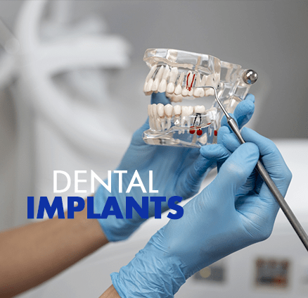 Dental Implants Can Restore Confidence to Your Smile