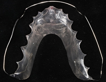 Occlusal bite problems and TMJ dysfunction