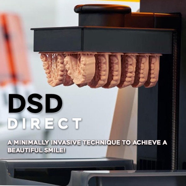 Achieve a Beautiful Smile with DSD Direct at Vilafortuny Dubai: A Minimally Invasive Technique