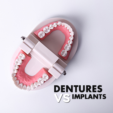 Dental Implants vs. Dentures: Which Is Right for You?