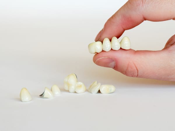 Zirconia Crown Result 2